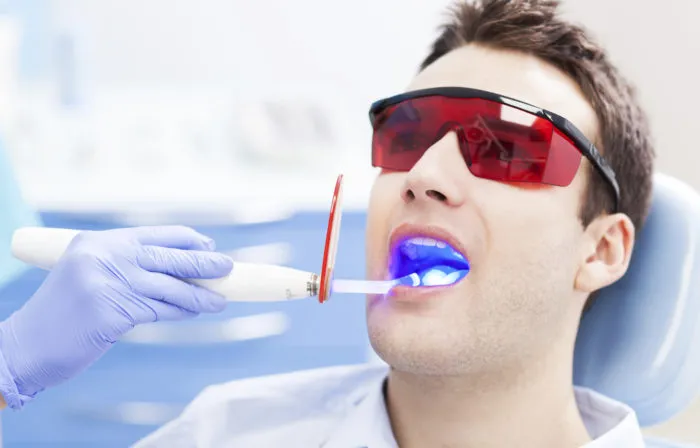 laser teeth whitening a good alternative for you-Dentist in Atascadero